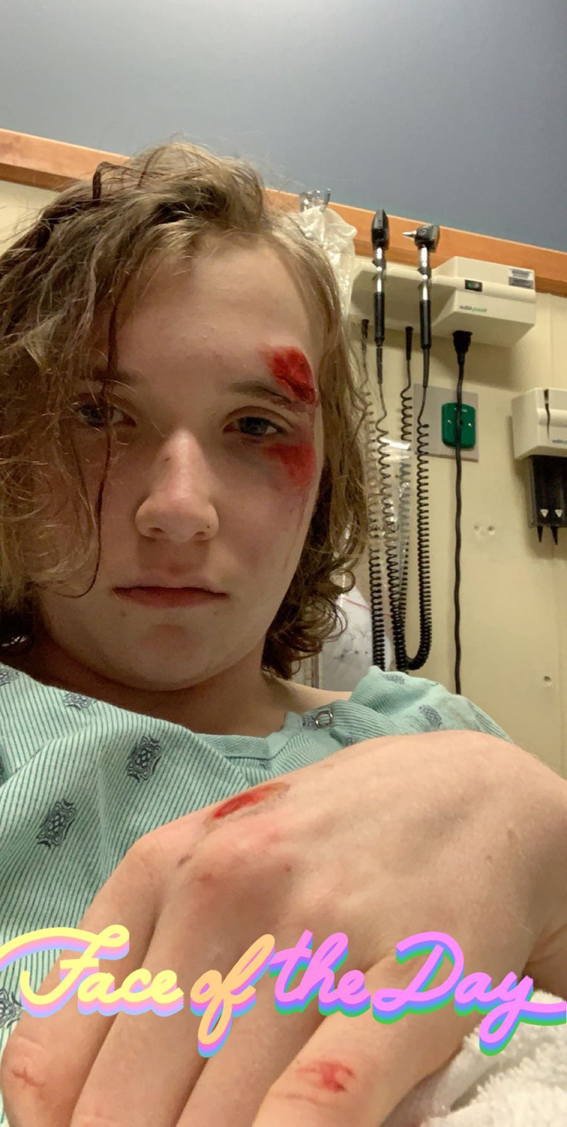 Illustration for article titled I Crashed a Moped and Hurt Myself